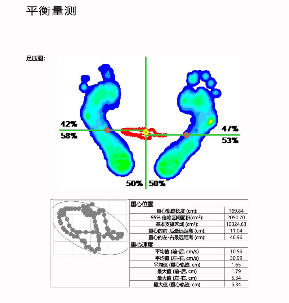 进行足部扫描足部健康评测.jpg